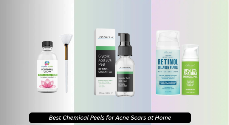 8 Best Chemical Peels for Acne Scars at Home 2026