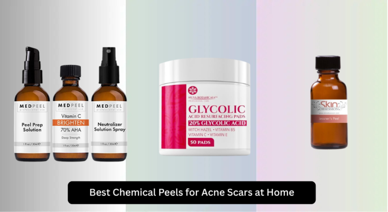 8 Best Chemical Peels for Acne Scars at Home 2026